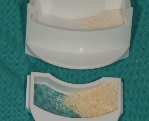 Slika 4. Razdvojene čestice dentina s obzirom na veličinu čestica. (Preuzeto s dopuštenjem autora: doc. dr. sc. Marko Vuletić)