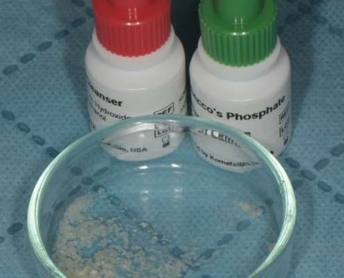 Slika 5. Kemijsko pročišćavanje (demineralizacija) čestica dentina. (Preuzeto s dopuštenjem autora: doc. dr. sc. Marko Vuletić)